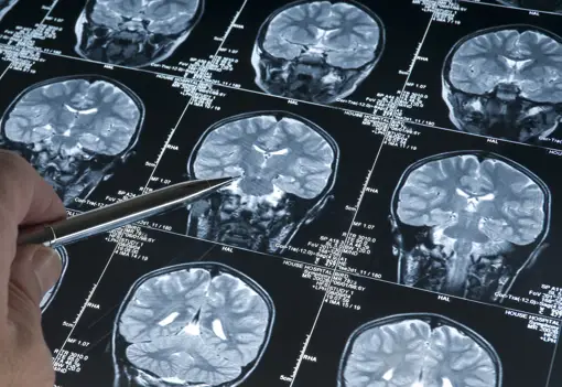 Brain Scan Close Brain Scan Close