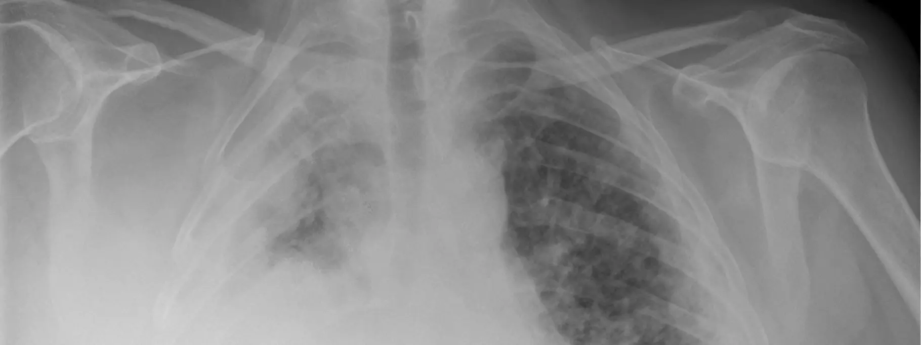 Insclaims_Dpi_Occupationaldisease Insclaims_Dpi_Occupationaldisease